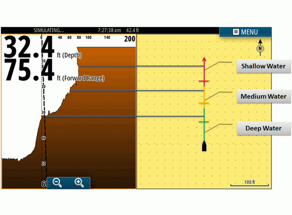 ForwardScan ™ transducer Painestore