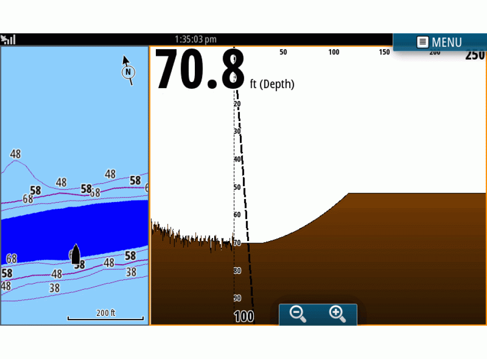Transductor ForwardScan™   Painestore